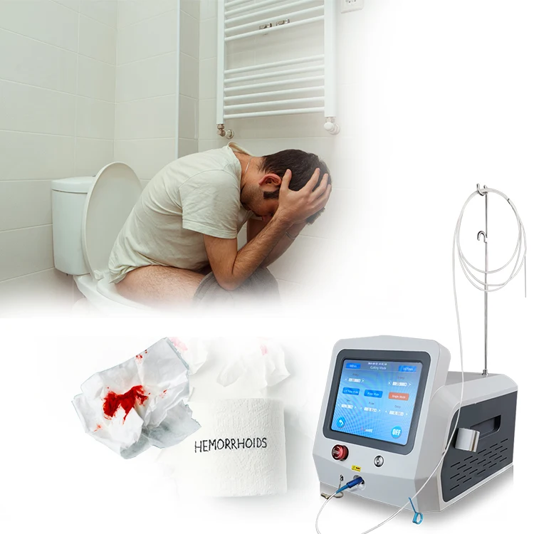 Triangel 980nm 1470nm diode laser anal hemorrhoids treating fistula therapy machine