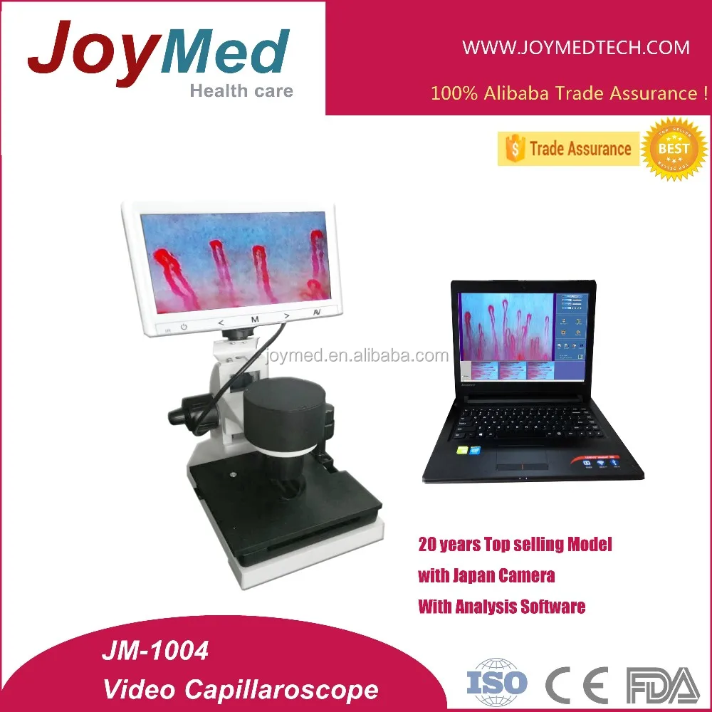 JOYMED JM-1004C Noninvasive capillaroscope nail bed capillaroscopy test system with analysis software