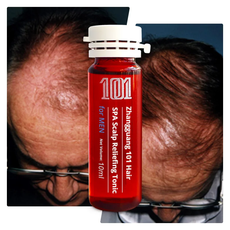 High Quality Deep Nourishing Scalp Natural Hair Growth Serum for Men