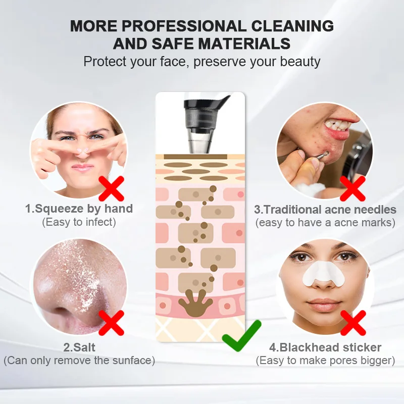 Electric Vibration Vacuum Suction Blackhead Remover Machine Hot and Cold Compress Whitehead Pimple Extractor Face Pore Cleaner
