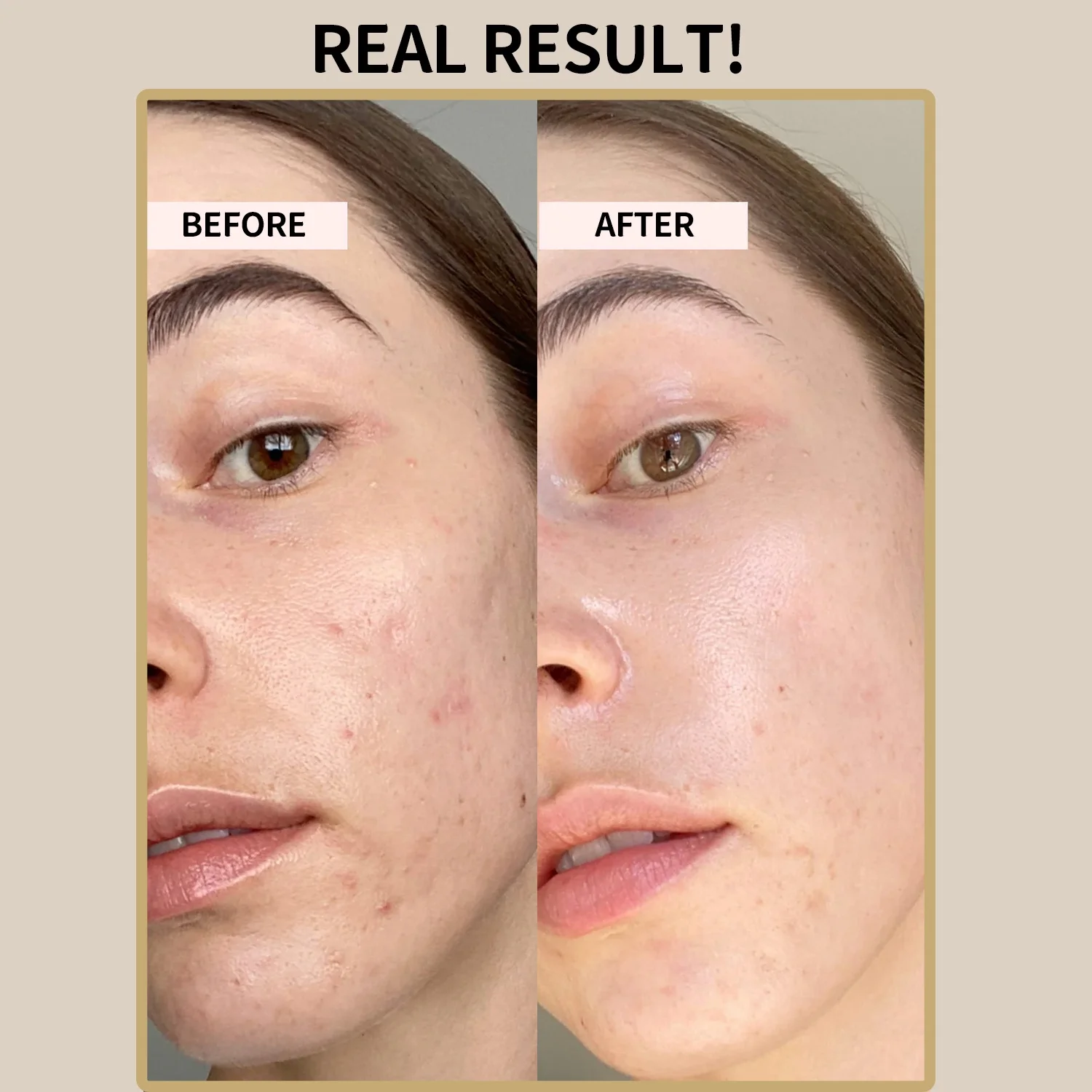 Rice & Honey Glow Mask Acne Calming Moisturizing Exfoliating Skin Care Korean Beauty Face Mask