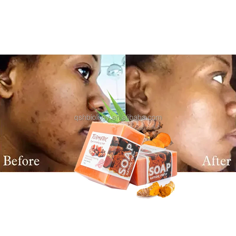 Organic Ginger Handmade Tumeric Bar Soap African Beautiful Facial Bath Anti Acne Dark Spots Skin Whitening Turmeric Soap