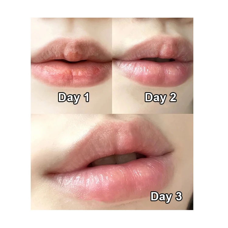 Private Label Moisturizing Repairing Fade lip lines Vitamin E lip mask lip care