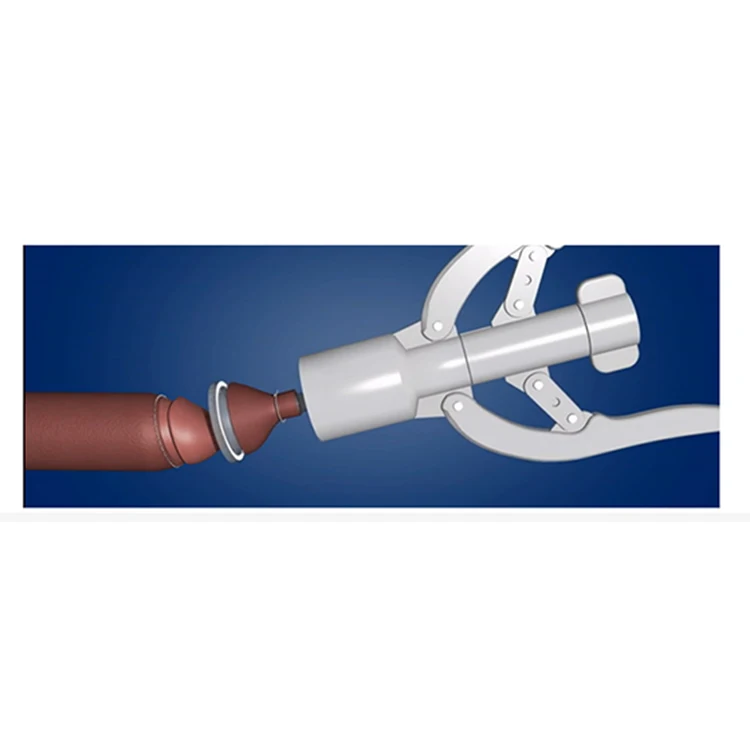 Factory Direct Sales Guaranteed Quality Convenient Operation Disposable Circumcision Suture Device