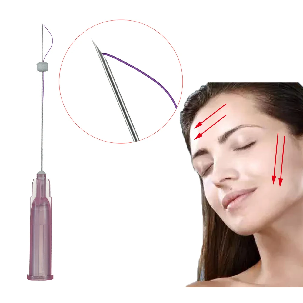 
 Моно-резьба Pdo для заполнения, предотвращающая морщины, 30 г, 25 мм, сертификация CE  