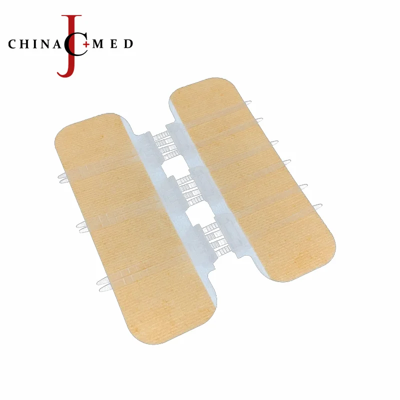 
Неинвазивное устройство замыкания ран 