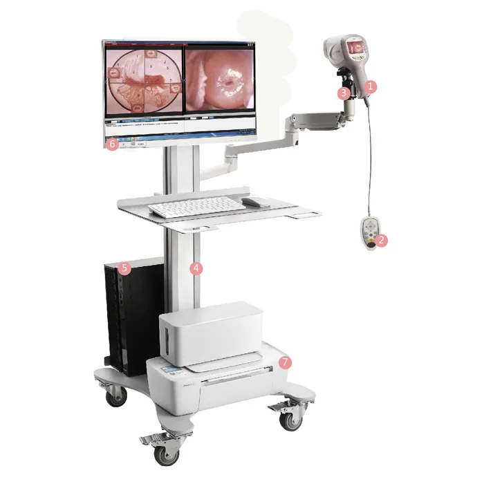new design high definition COLPOSCOPY colposcope with great price KN-2200 gynecology Cervical Colposcopy Camera