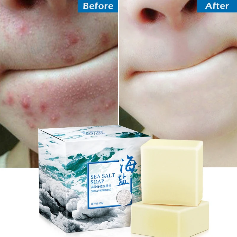 100g Removal Pimple Pore Acne Treatment Sea Salt Soap Goat Milk Moisturizing Glycerin Soap Base Whitening
