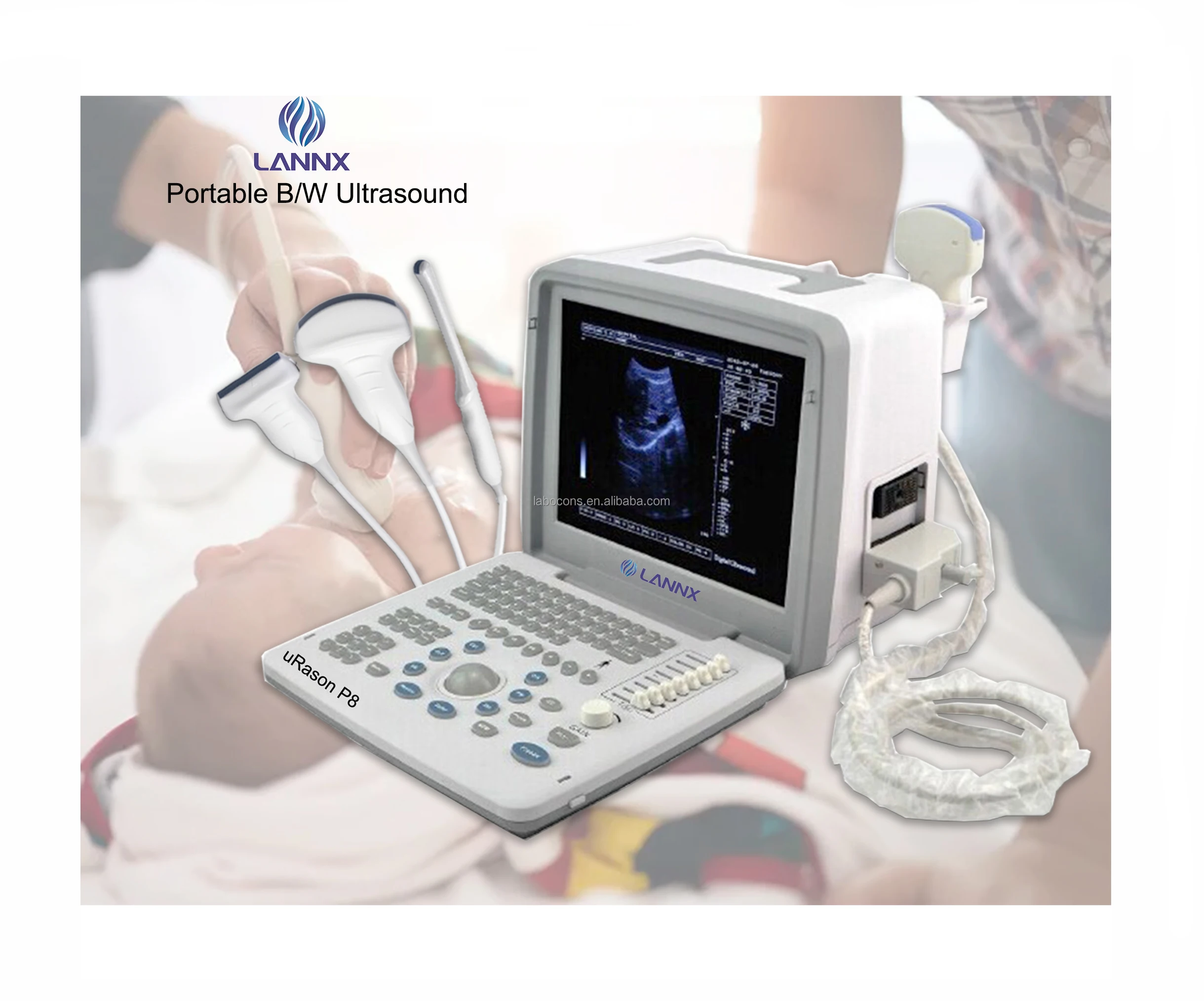LANNX uRason P8 High cost-effective medical diagnostic ultrasound scanner device portable Notebook B/W USG machine