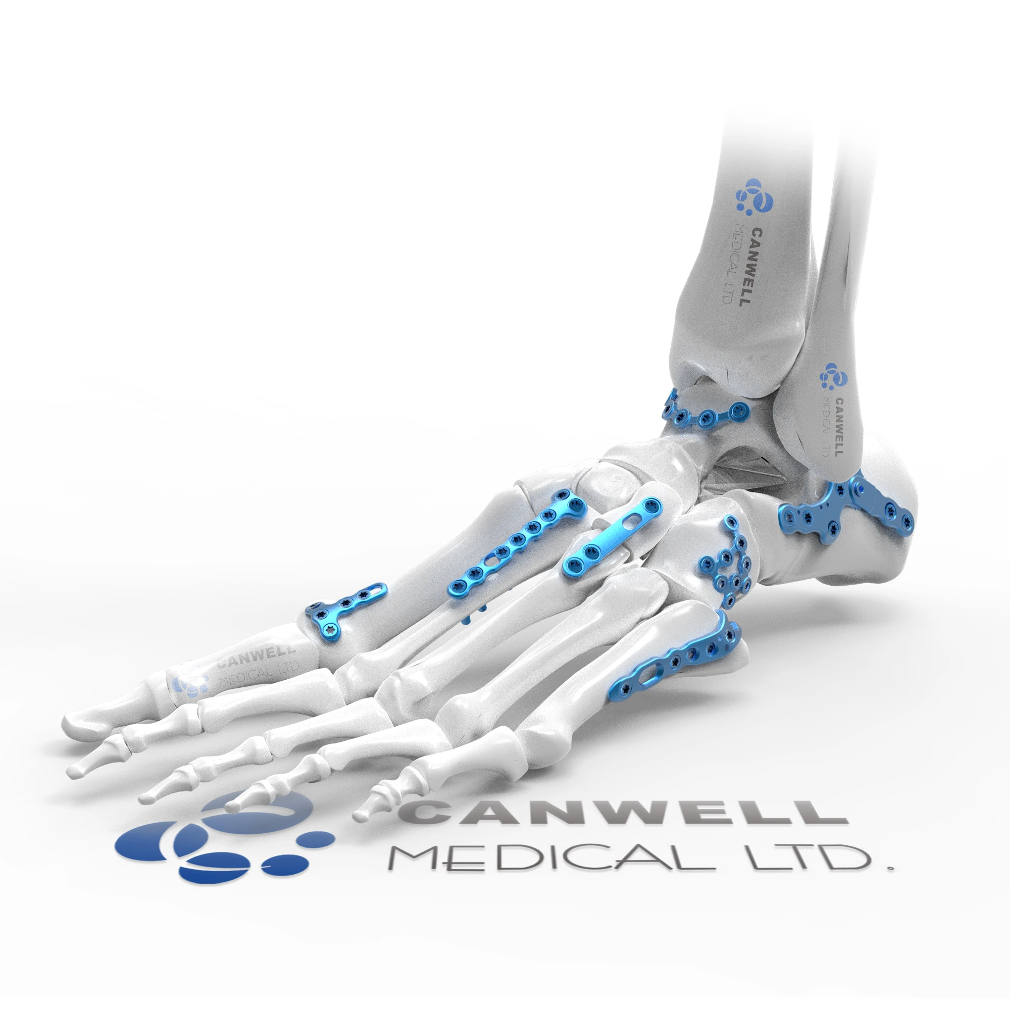 CANWELL Orthopedic Implant Titanium 2.7mm Foot&Ankle Fusion Plate Orthopedic Locking Plate