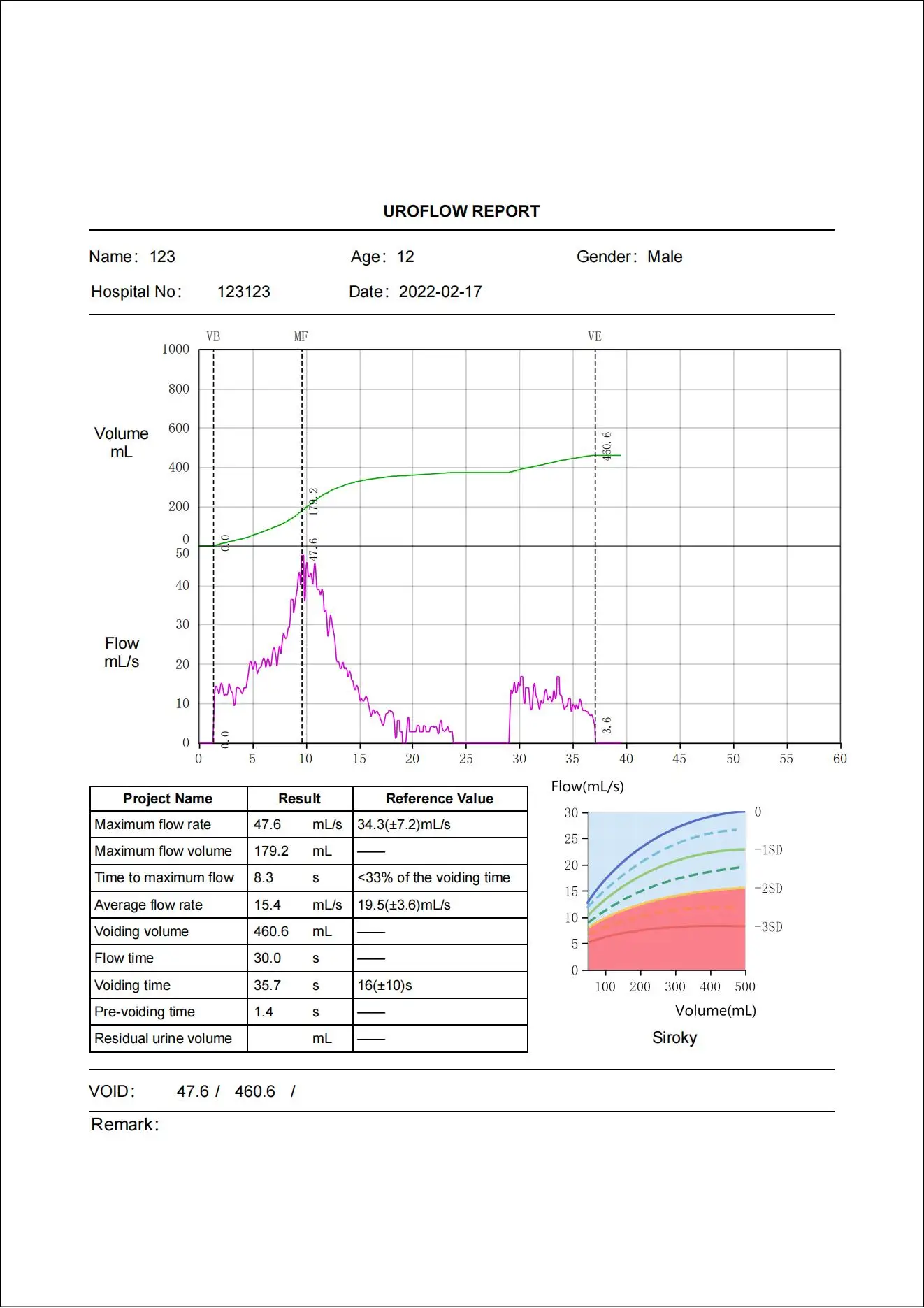 Urodynamics Test System Uroflowmetry In Bph Uroflow Normal Values