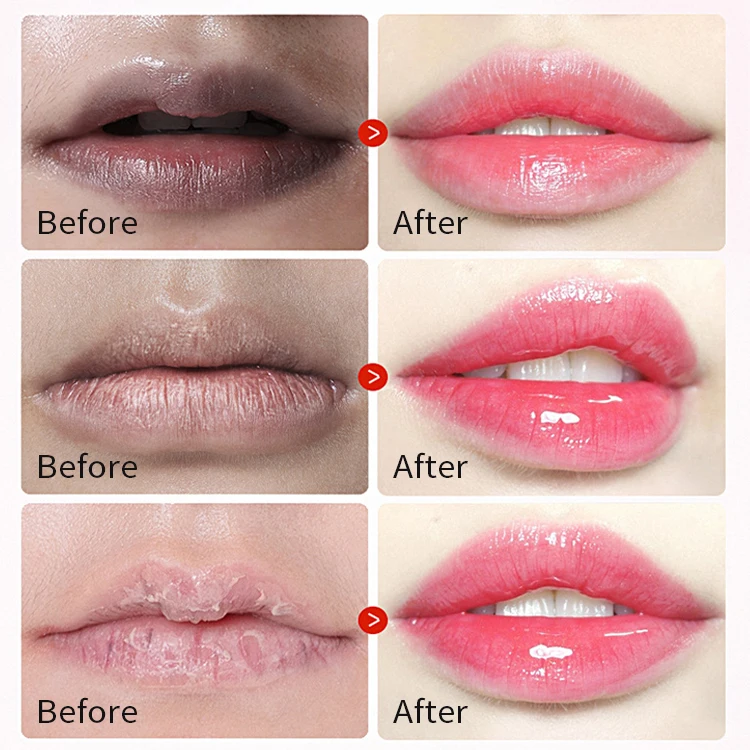 OEM Lips Care Crystal Patch Masks Sheet Rebranding Cosmetics Wholesale White 24K Gold Pink Hydrogel Collagen Lip Mask