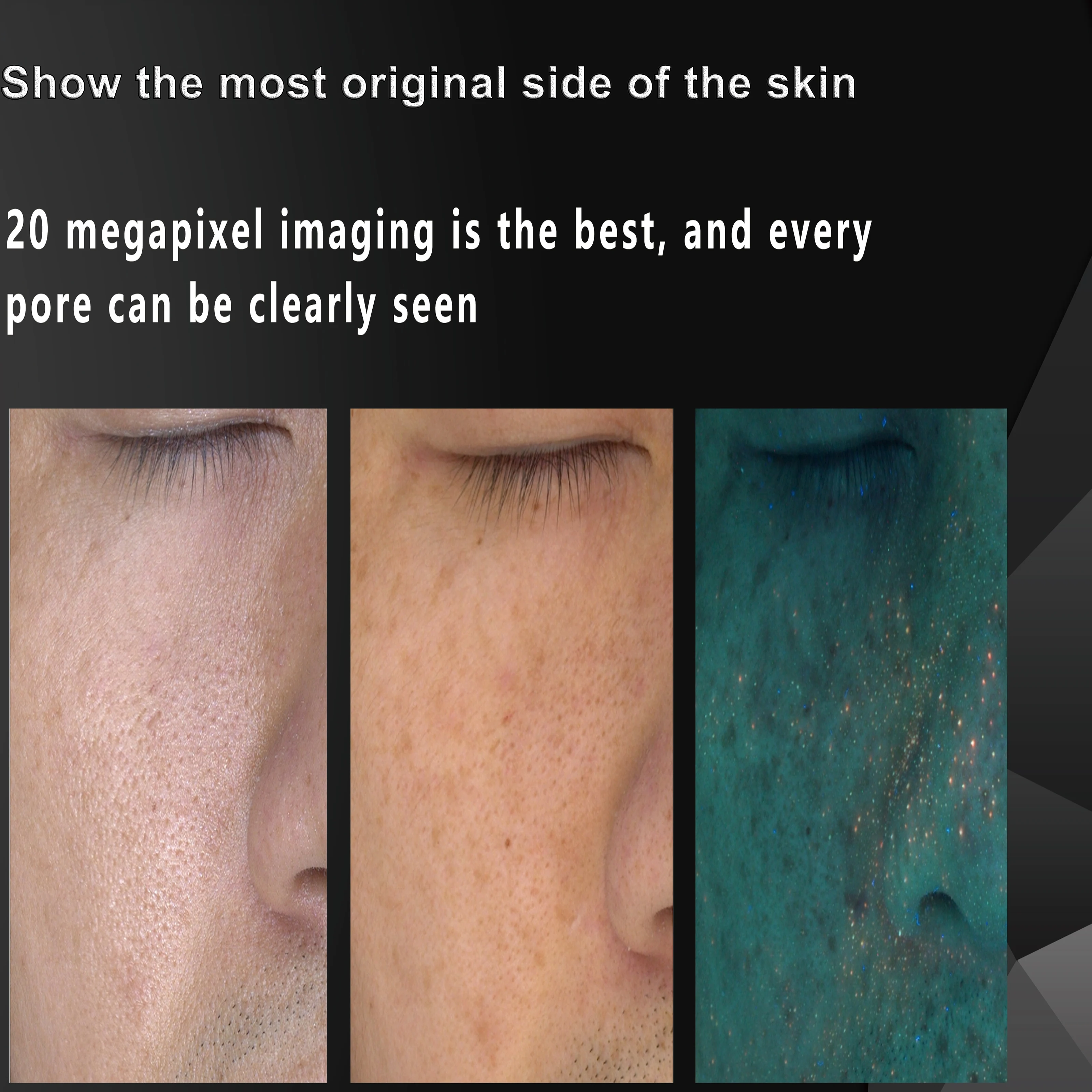 New Product Facial Skin Analysis Machine 3d Skin Analyzer With Customized Solutions