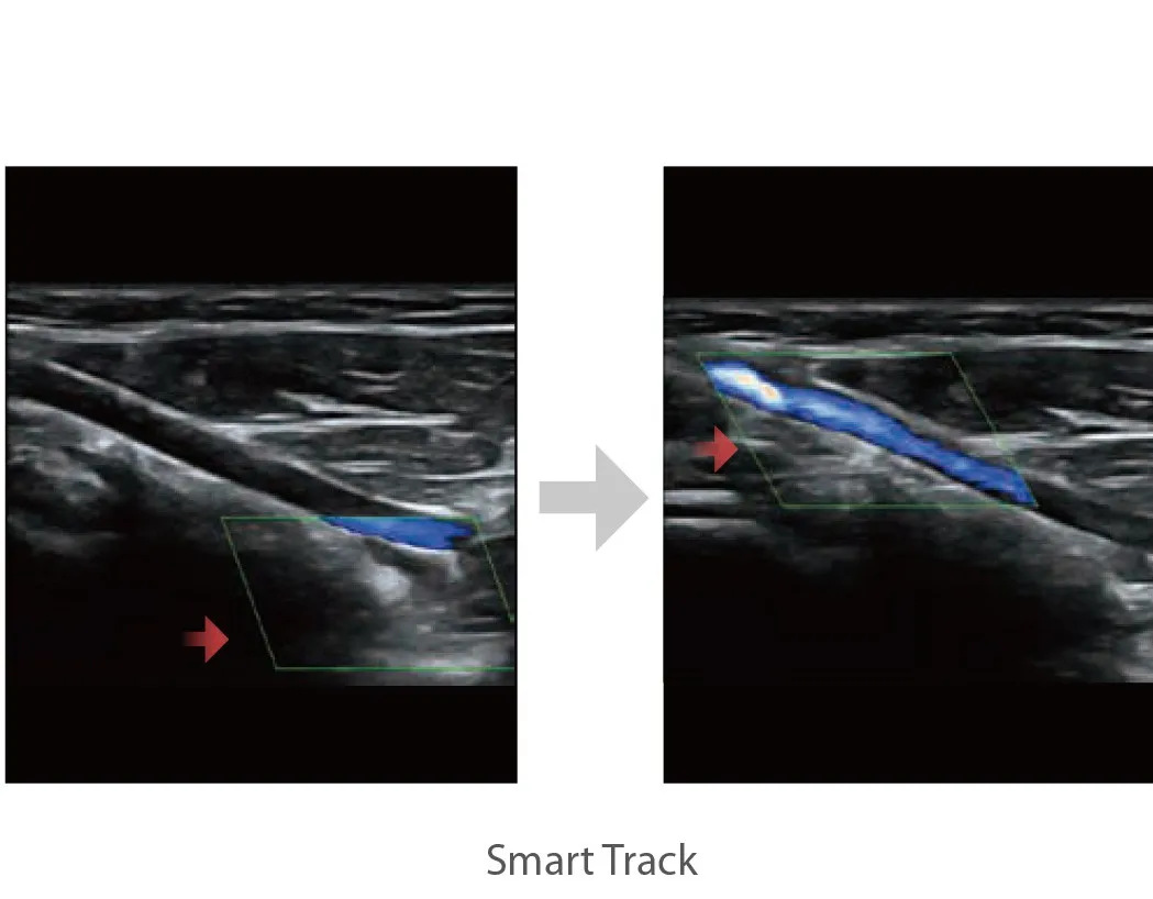 High quality Mindray DC-60 Diagnostic Ultrasound System for hospital use