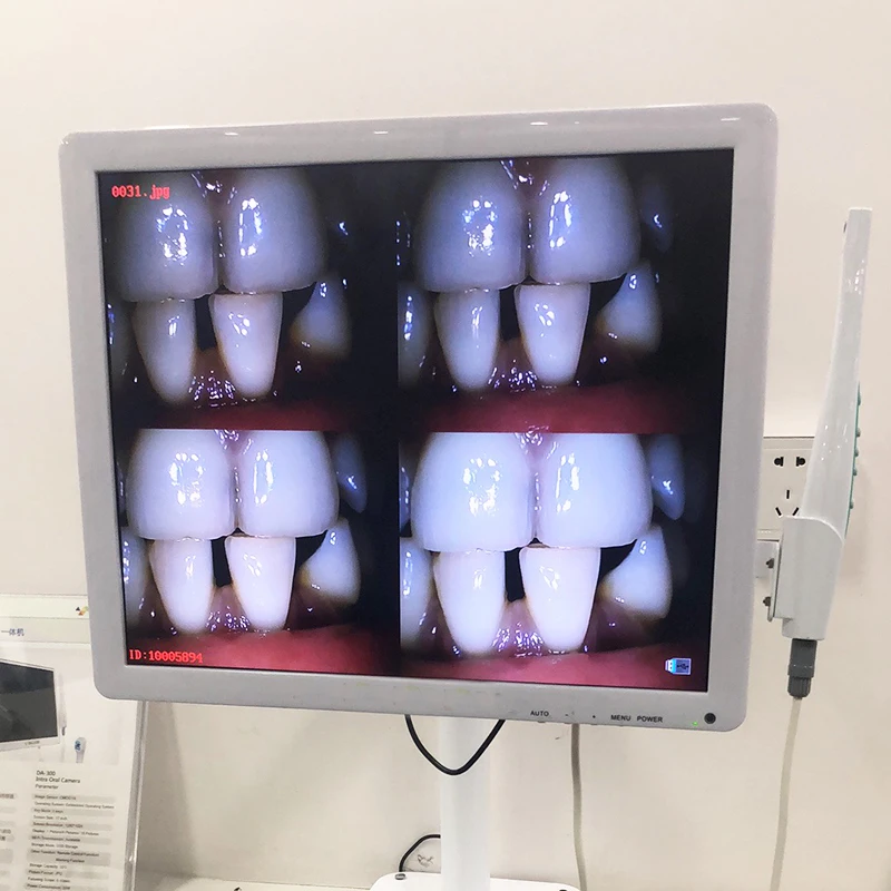 Dental Camera Wifi HD 8 Million Pixels High-definition Endoscope Tools 17 Inches Digital LCD Monitor Dental Intraoral Instrument
