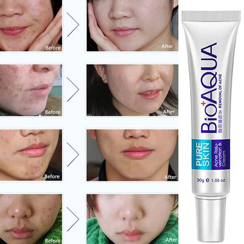 Hot selling Scars Removal Face Cream Light Print Beauty Pure Skin Care Whitening Facial Moisturizing Cream Acne Treatment Cream