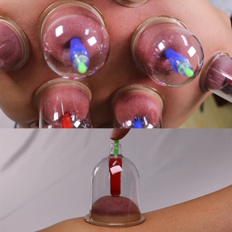 24 шт.; Оптовая продажа; Детское нижнее белье hijama Кубок терапия в традиционном китайском стиле самолечения Пластиковые Чашки Набор