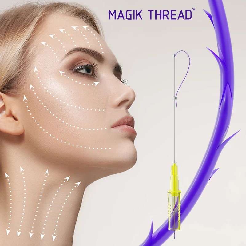 sterile 3d cog polidioxanona fio de sutura v-lift for cosmetic use