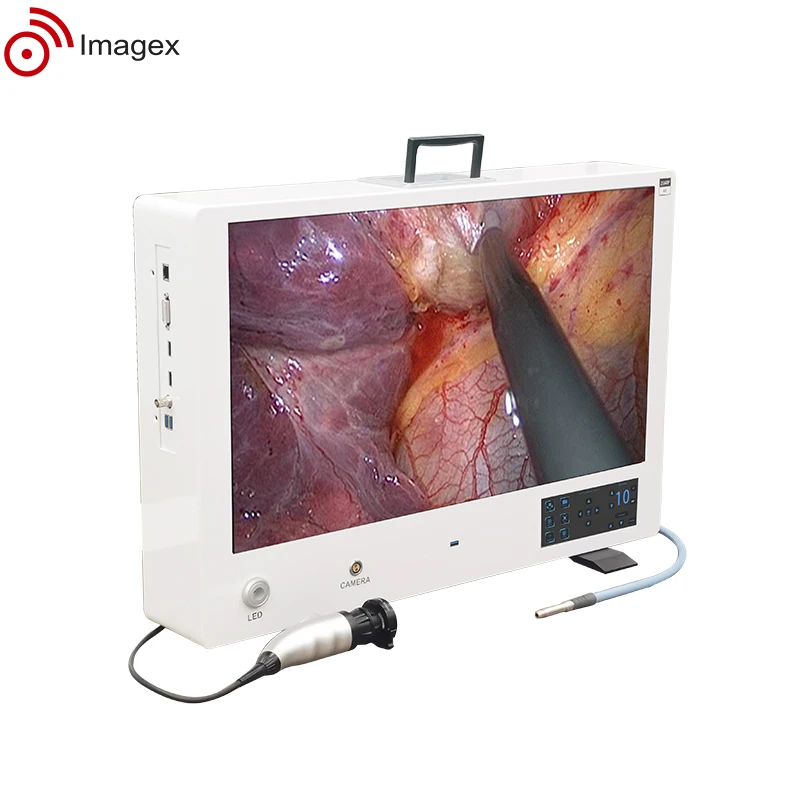 2K 4K Compact integrated Endoscopy camera system for endoscopic surgery