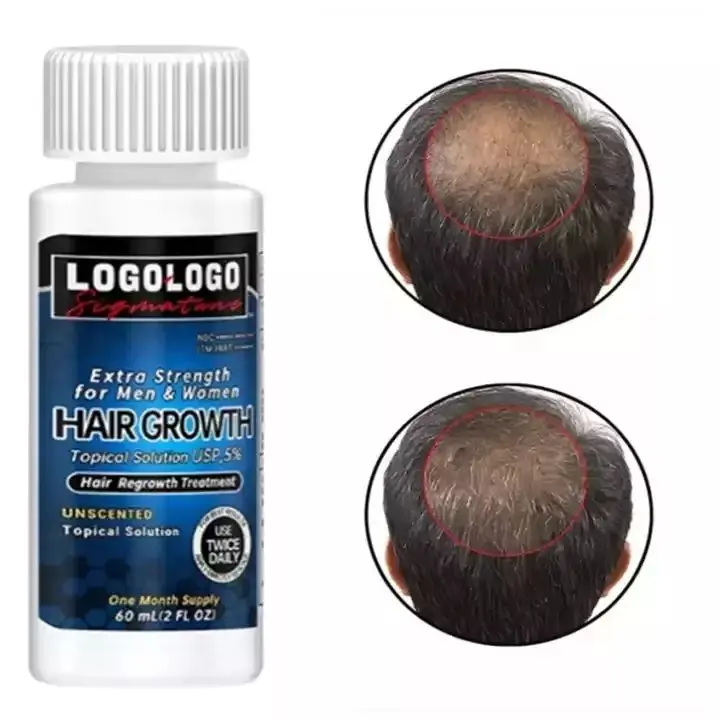 LYW Private brand 5% Hair Loss Treatment Regrowth Serum Oil Hair Lotion Hair Growth Serum with Dropper