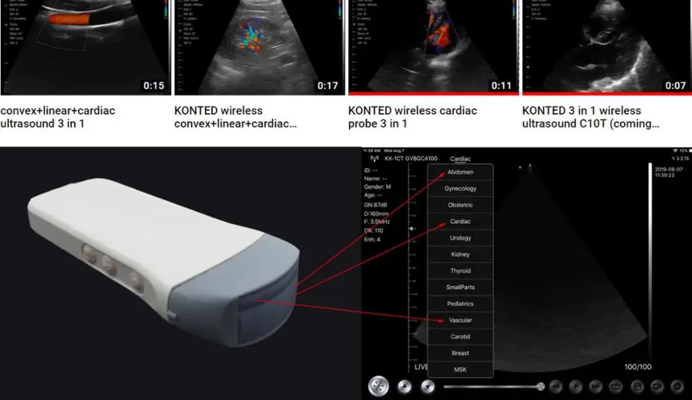 Konted Gen5 ладони ультразвуковой портативный беспроводной ультразвуковая машина 3 в 1 Многофункциональный одиночный датчик для всего тела