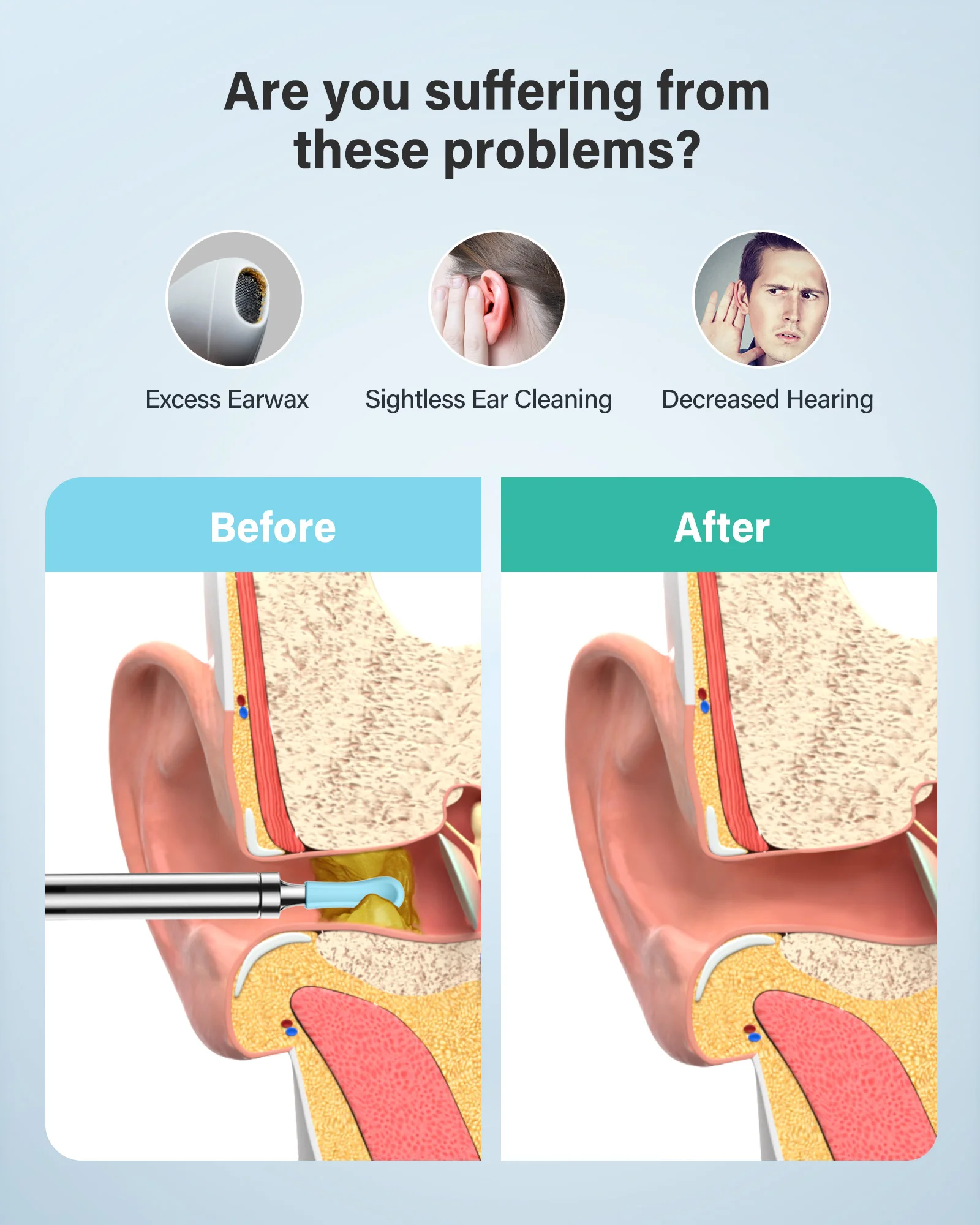 New Health Care Ear Nose Throat Examination Video Otoscopio Wifi Otoscope Wireless Endoscope Camera