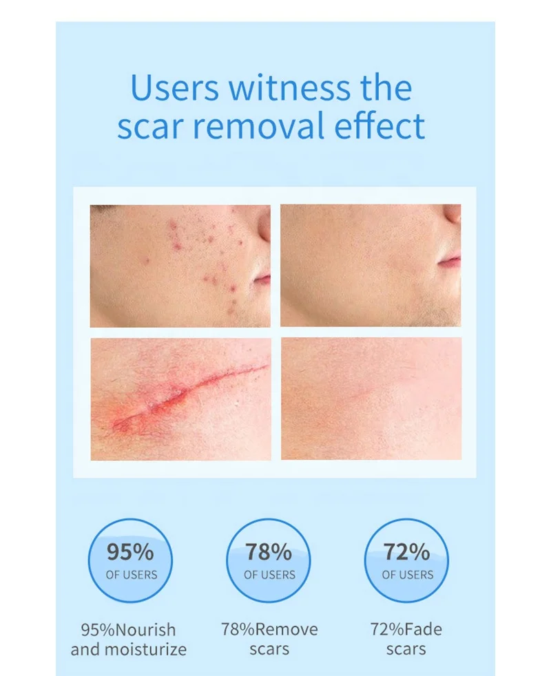 New Arrive 30g Organic Herbal Repair Gel New Old Scars Skin Face Body Scar Removal Gel Ointment