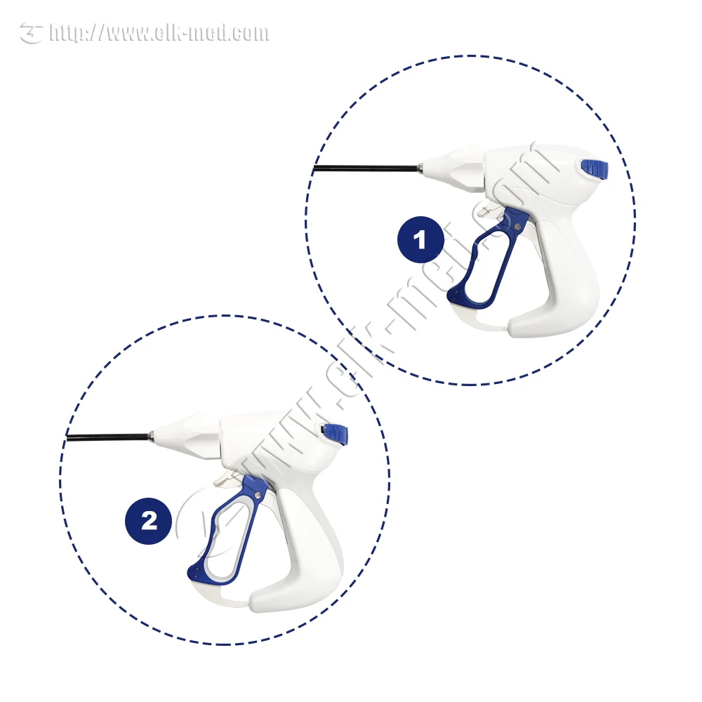 Ligasure лапароскопический maryland инструкции по использованию лигасурного сосуда для герметизации