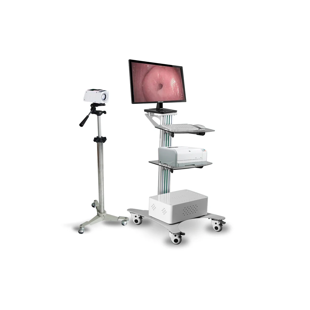 MY-F004A Trolley-type medical Digital Electronic Colposcope Video  China Electronic Colposcope price for gynecology