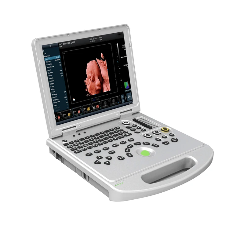 3D 4D Color Doppler Ultrasound Scanner Machine Portable Ultrasound