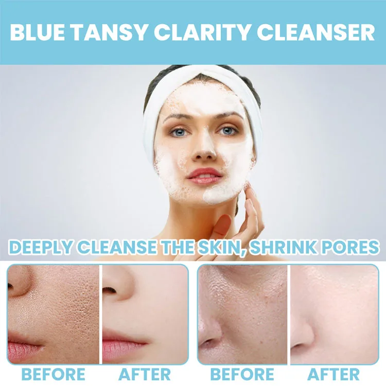 Wholesale Private Label Deep Clean Anti-Acne Gentle Remove Oily face wash facial cleanser for All Skin