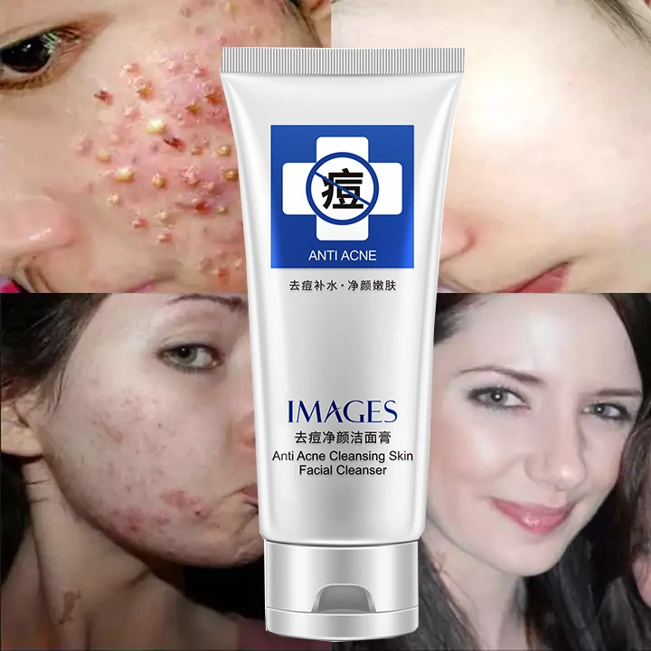 OEM IMAGES Cleaning skin Acne treatment pimple patch pimple dark spot remover face care cream facial cleanser