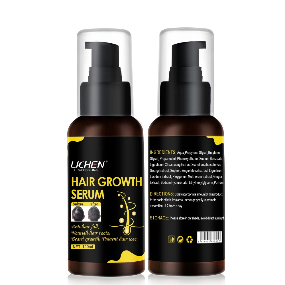 Лучший результат, сыворотки для быстрого роста волос ginger, Органическая натуральная формула, оптовая продажа для афроамериканских волос