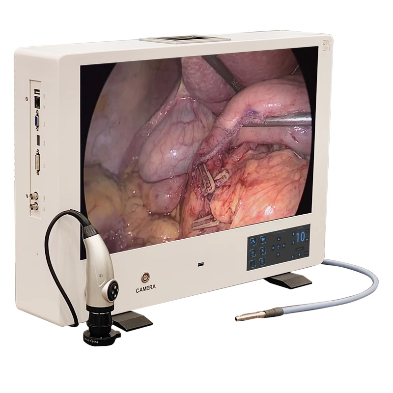 19/22/24inch ENT anti-moiree Portable 1080p HD 4 in 1 Endoscope camera for rigid flexible endoscope