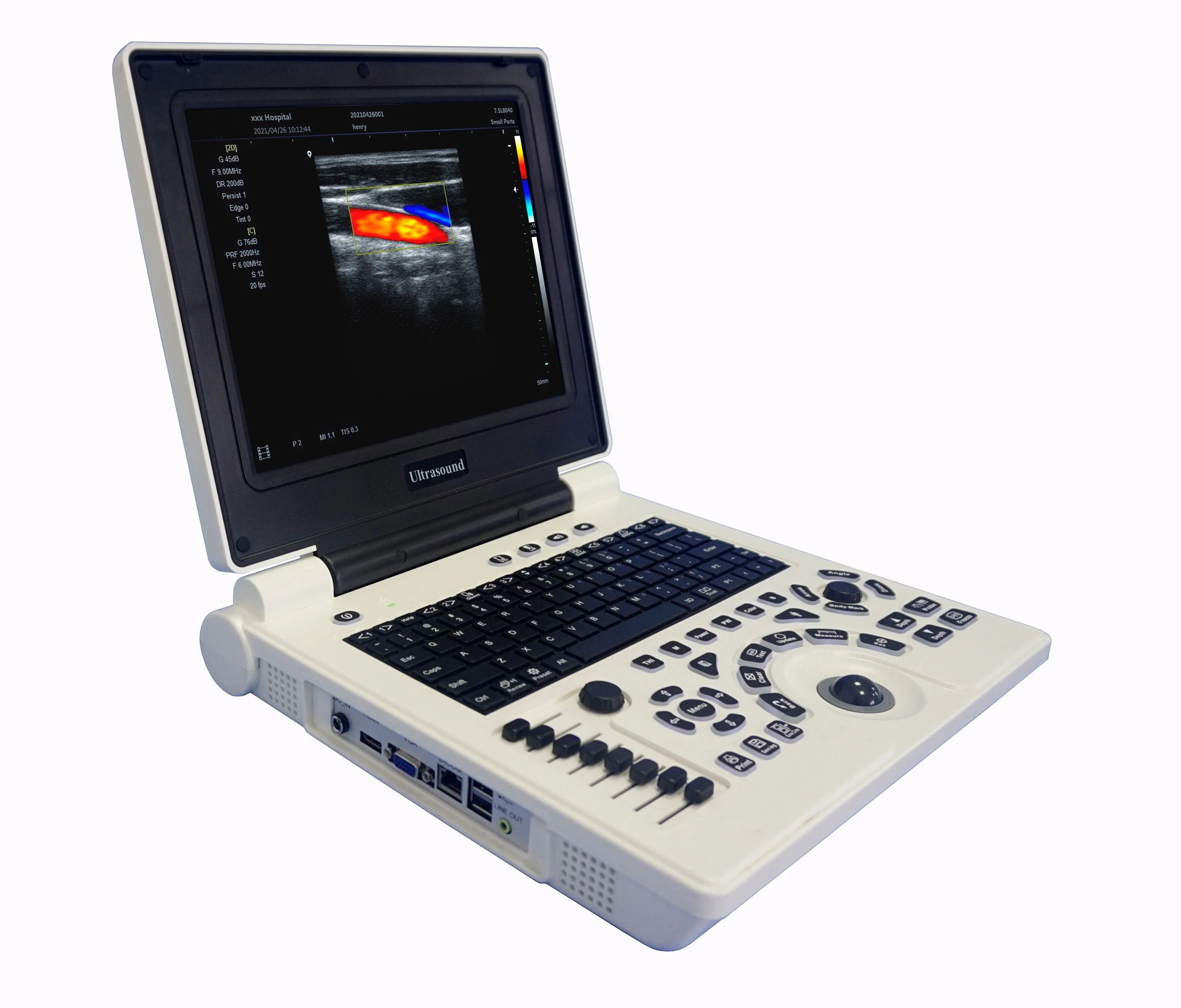 Portable 3D USG Laptop color ultrasound