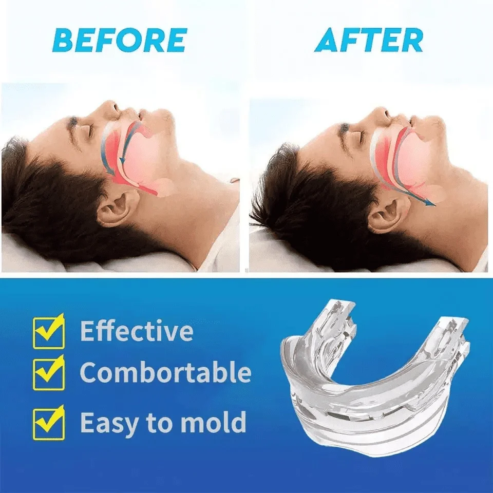 Hot Selling Adjustable Anti Snoring Mouthpiece Anti Snore Mouth Guard Device For Deeper Sleep