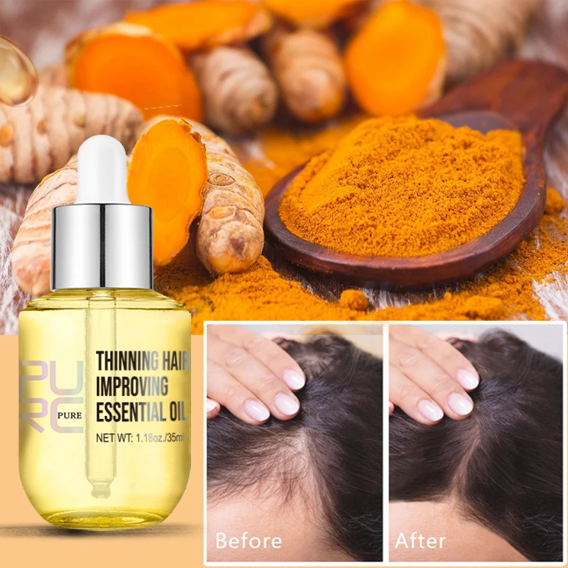 Private Label Natural Ginger Hair Density Essential Oil Fast Hair Regrowth Treatment Nourish Scalp Organic Hair Growth Oil Serum