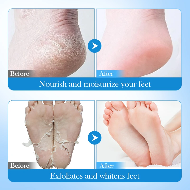 OEM FAYANKOU vegan avocado petroleum jelly moisturizing foot mask for whitening and soothing feet skin care product