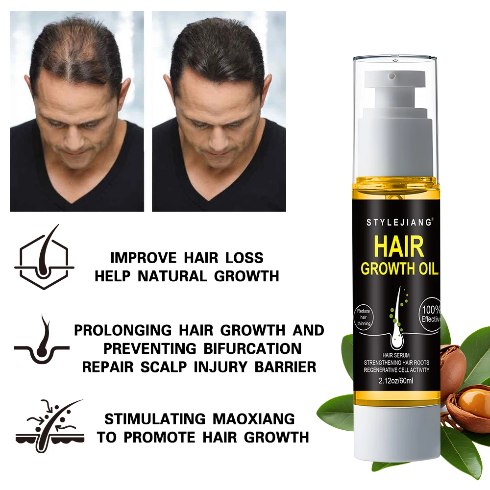 Factory OEM&ODM Anti-dandruff Moisturizing Hair Growth Oil for Men Hair Growth Oil Hair Scalp Care Products