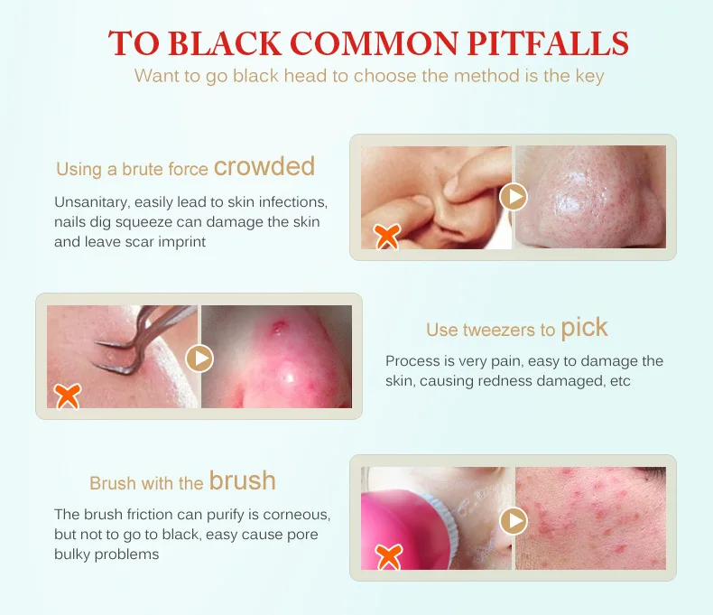 Volcanic Soil Facial Mask Acne Remove Blackhead Mite Propolis Face Care Treatment Repair Whitening Cream Skin Care Moisturizing