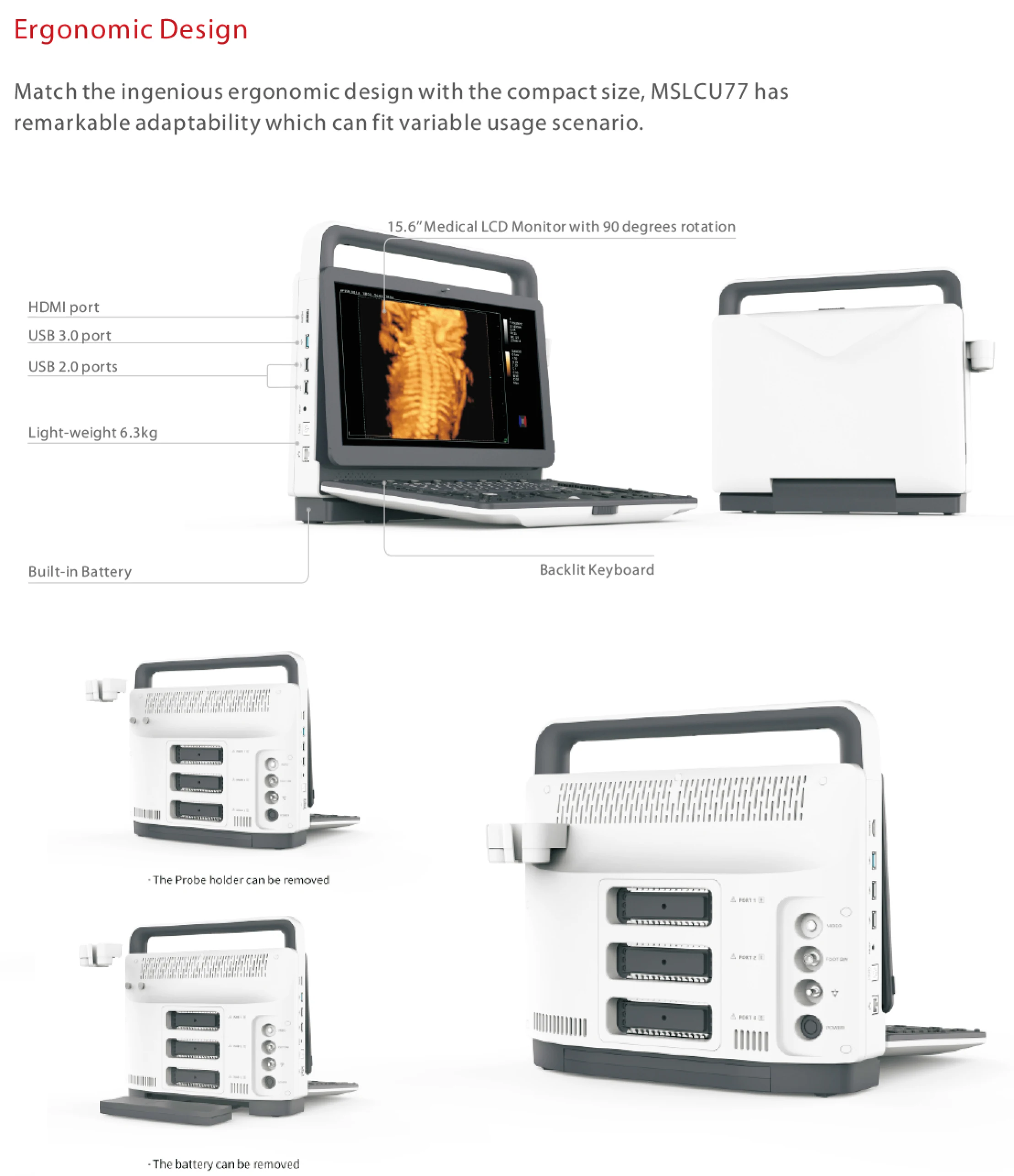 4d Портативный Цветной доплеровский ультразвуковой аппарат 3d цветной Ультразвуковой госпиталь для человека и ветеринарии