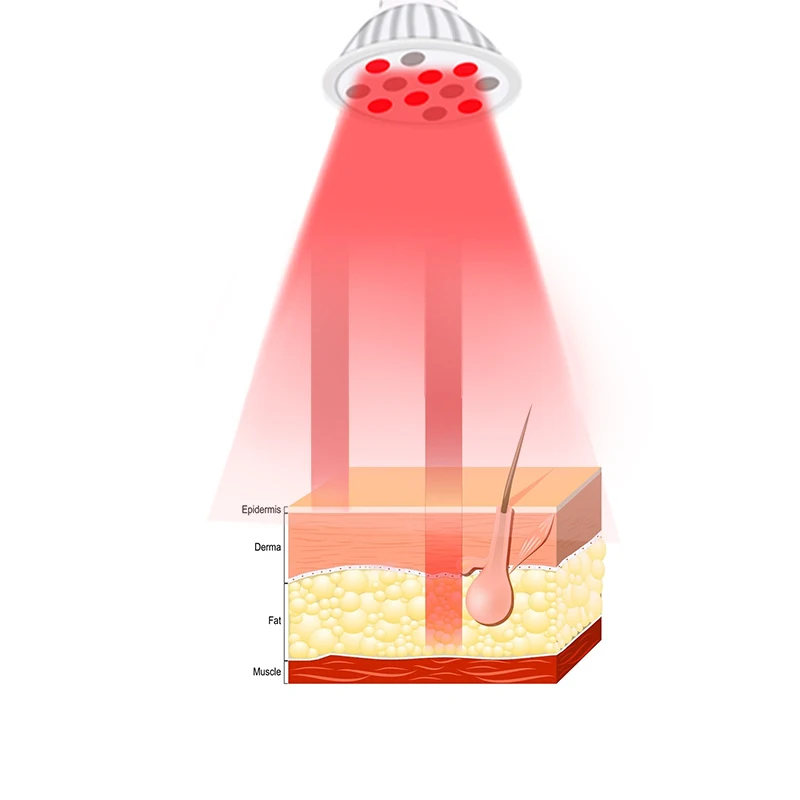Wound Repair Healing E27 Handheld 660nm 850nm 24W Red Infrared LED Light Therapy