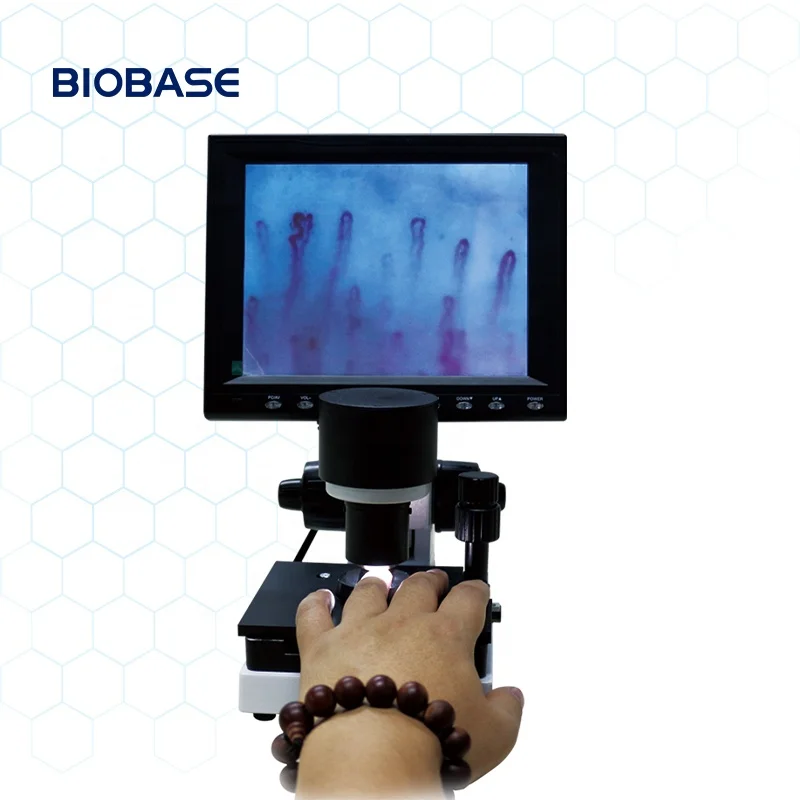 BIOBASE China Microcirculation Microscope WXH-8 capillary microscope/darkfield live blood analysis microscope