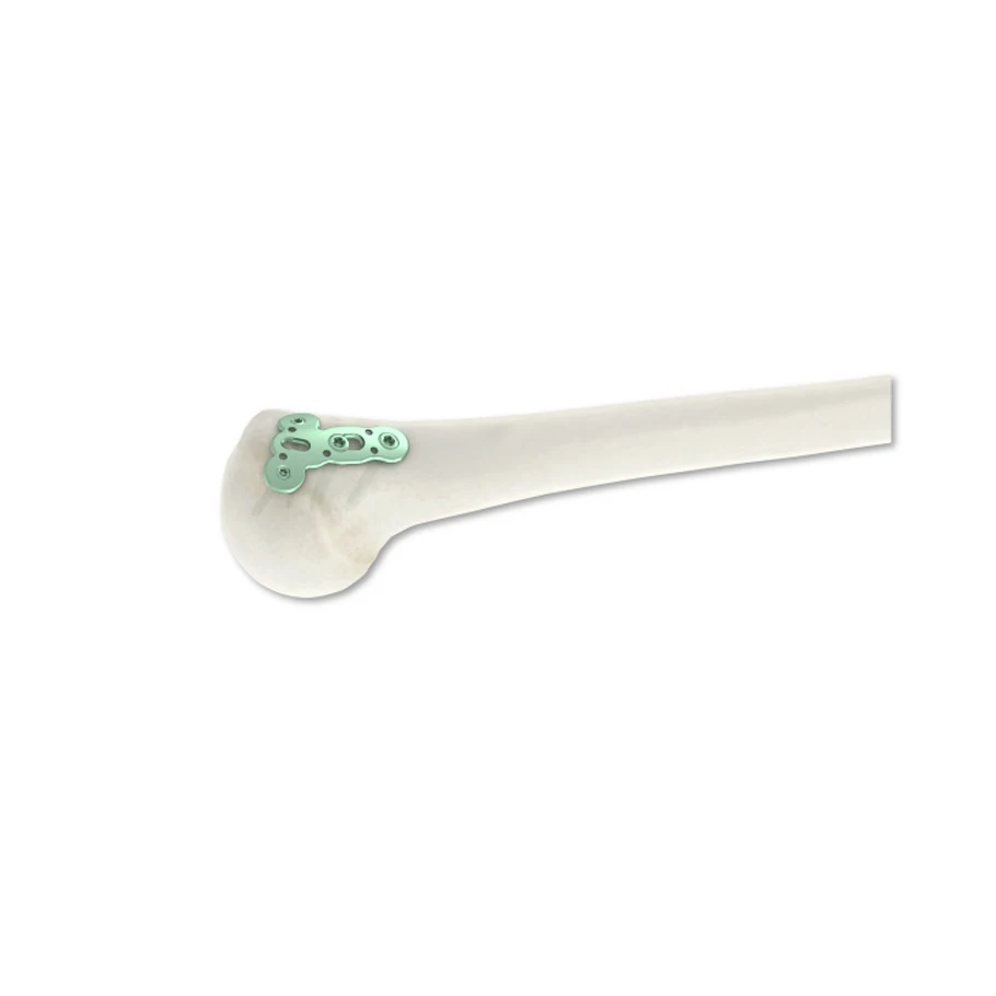 Premium Thickness 3.2mm Veterinary Orthopedic Distal Humerus Greater Tubercle Locking Plate Bone Plates And Screws