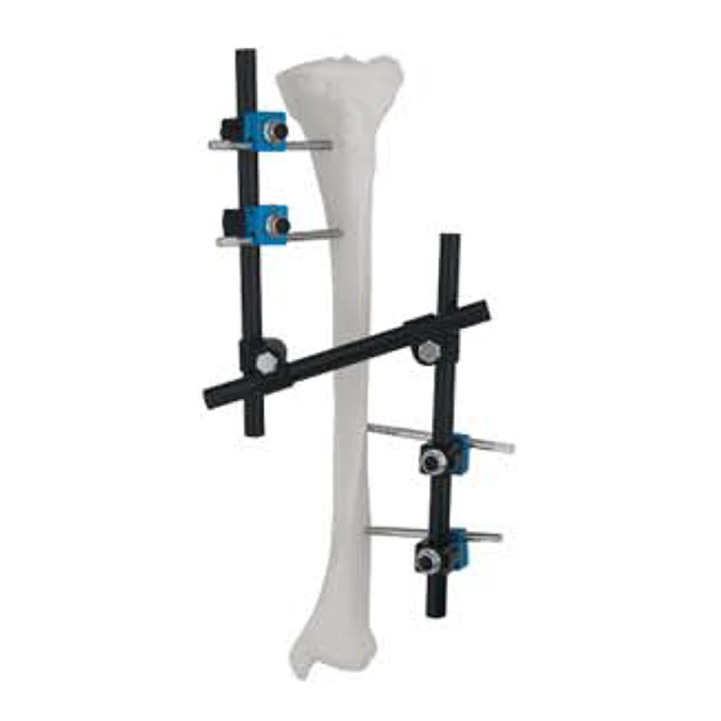 Отличное качество из нержавеющей стали ортопедический внешний фиксатор бедренной кости и внешней фиксации большеберцовой