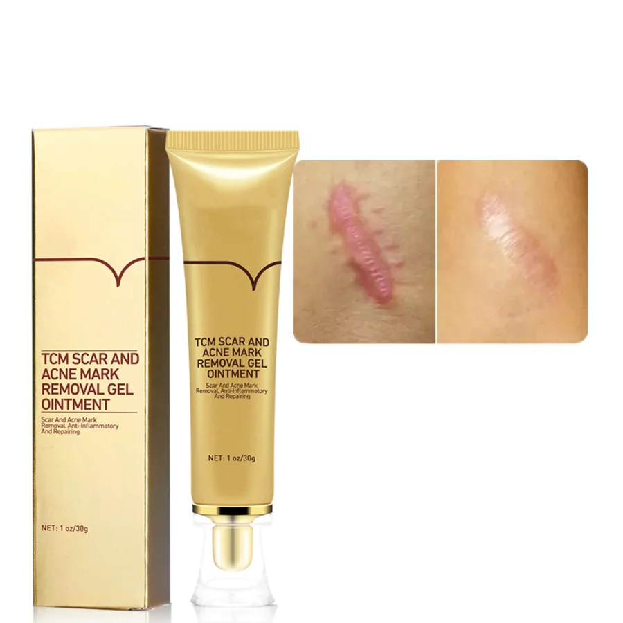 wholesale best sell Organic face body skin care repairing scar removal cream tcm scar acne mark removal  beauty gel
