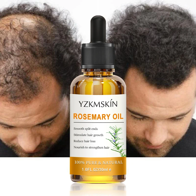 private label wholesale natural veganic organic rosemary hair growth oil wild fast growth hair essential oil clinically proven