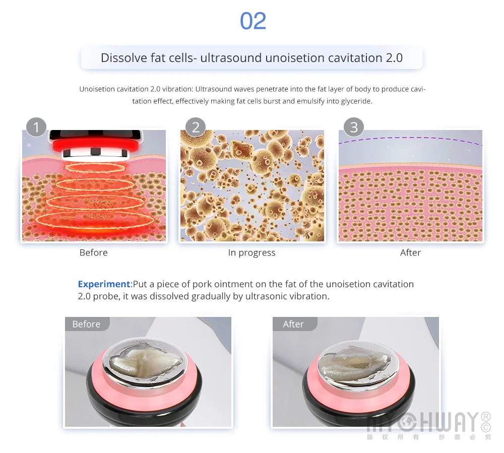 Mychway Cavitation Rf Equipment anti aging wrinkle machines Weight Loss Anti-cellulite Vacuum Cavitation System  device