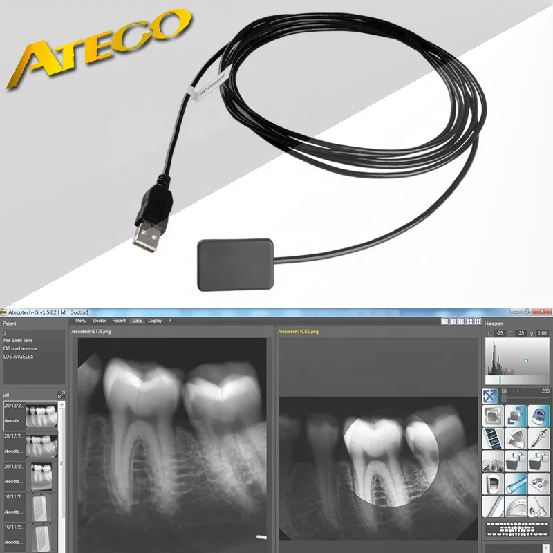  Аутентичный цифровой стоматологический рентгеновский Датчик UK Ateco
