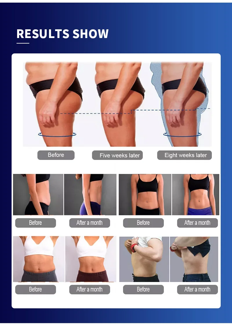 Infrared magnetic therapy pulsed electromagnetic field device relieves pain eliminates cellulite magnetic therapy machine